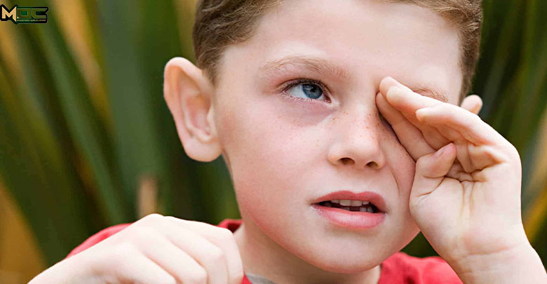 حساسیت چشمی کودک